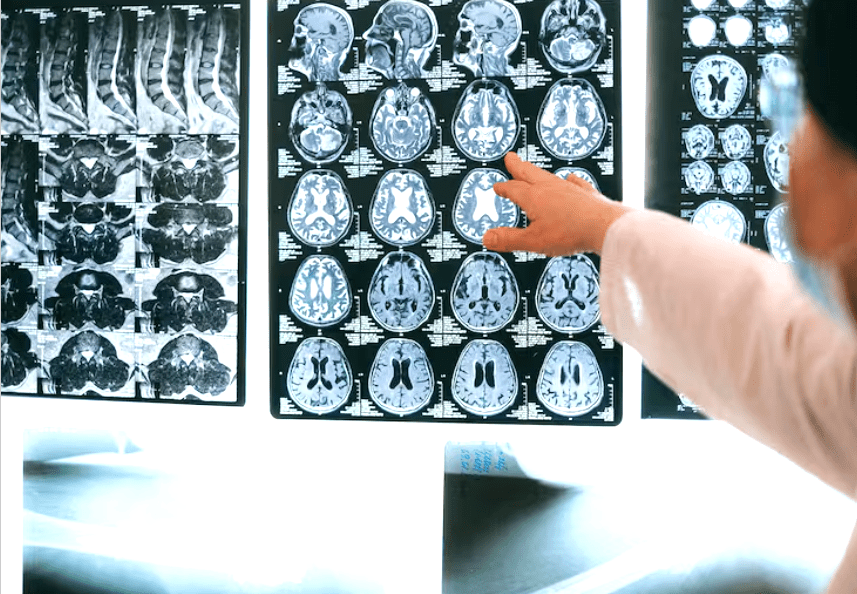 Investigación vincula infecciones de la infancia con mayor riesgo de demencia en&nbsp;adultos